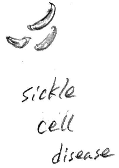 sickle_cell